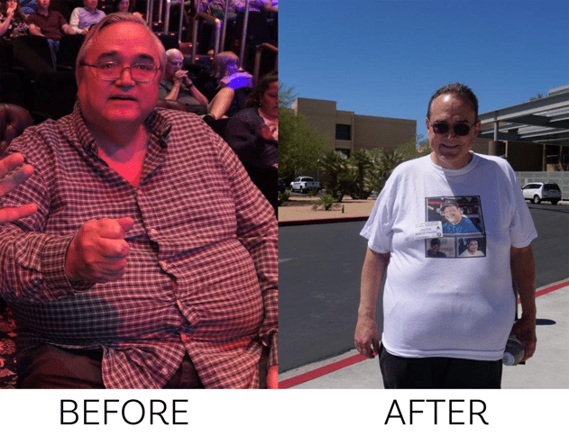 Before and after surgery image