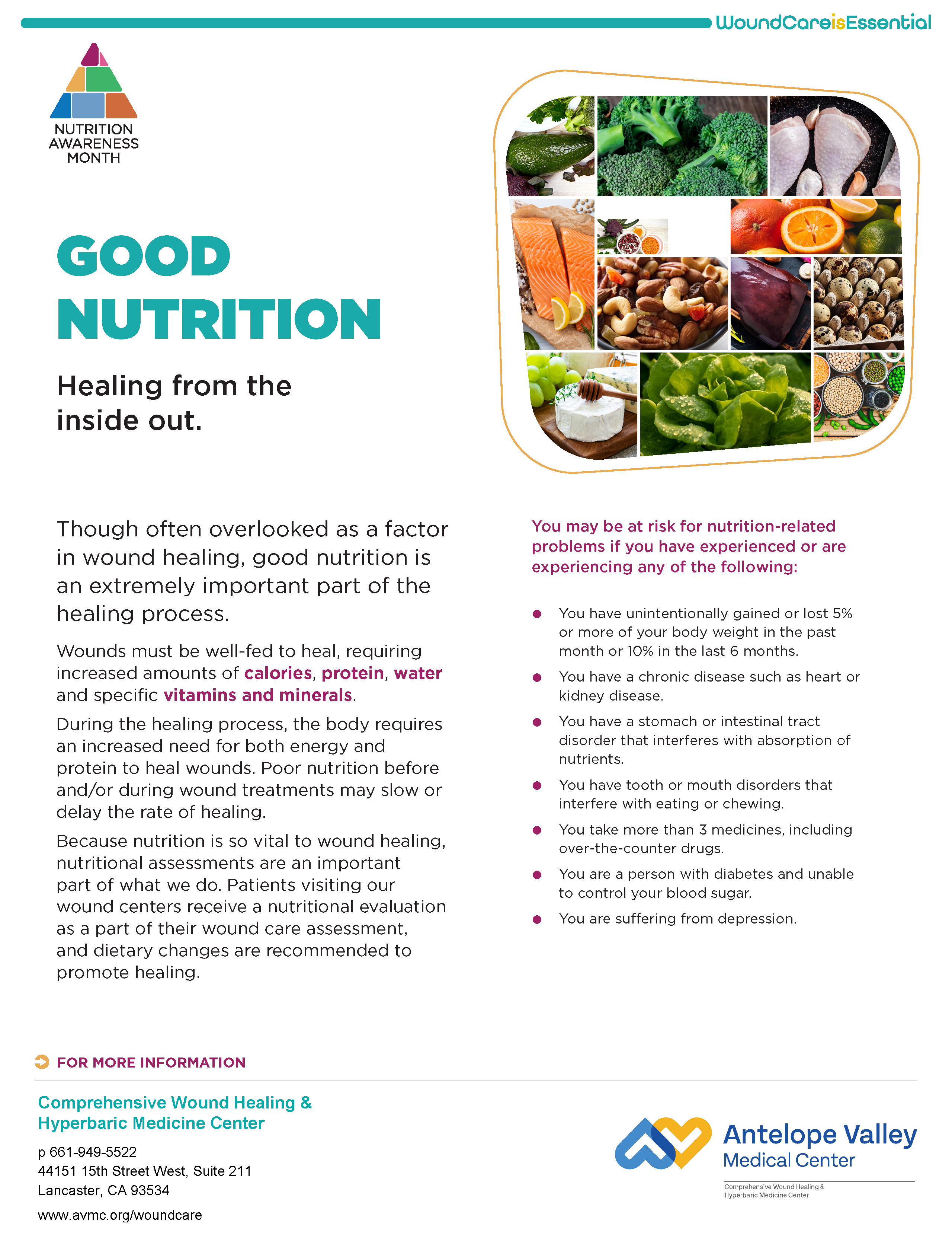 TREAT-March Nutrition Rev 112023